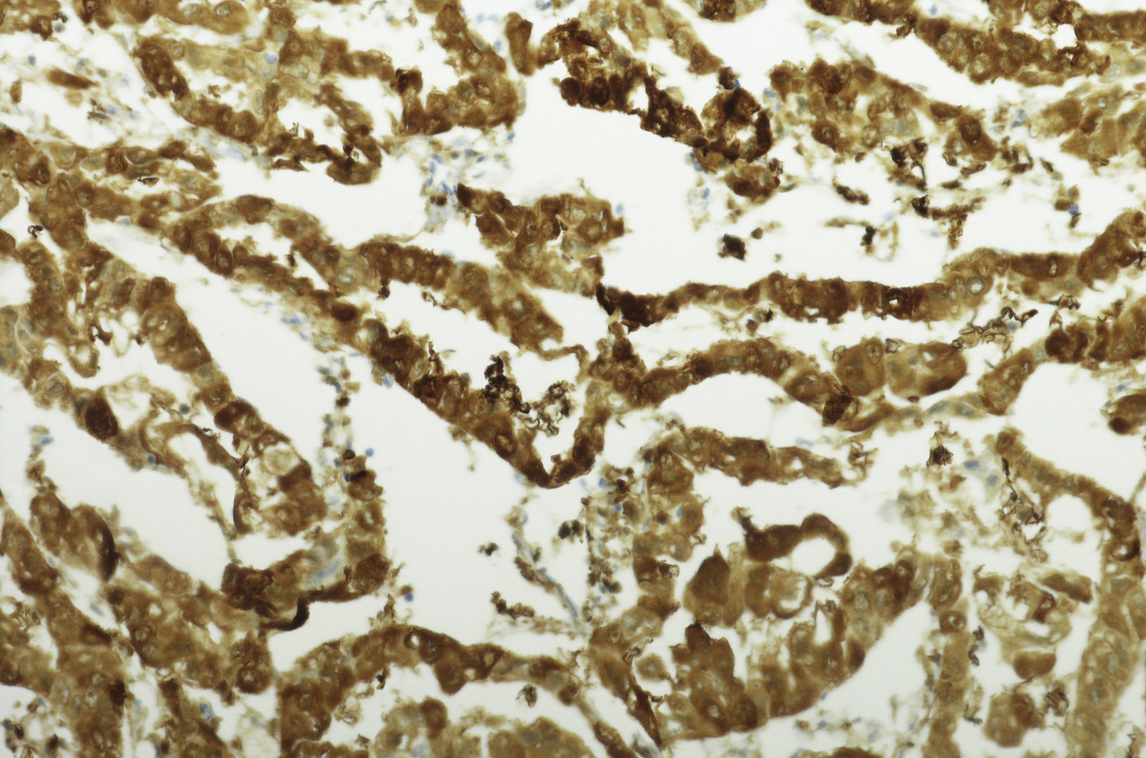 Glass of yellow-brown tannin-stained water from a shallow well